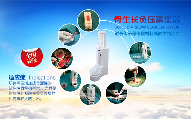 骨生長負壓富集器賦予骨材料新的生命